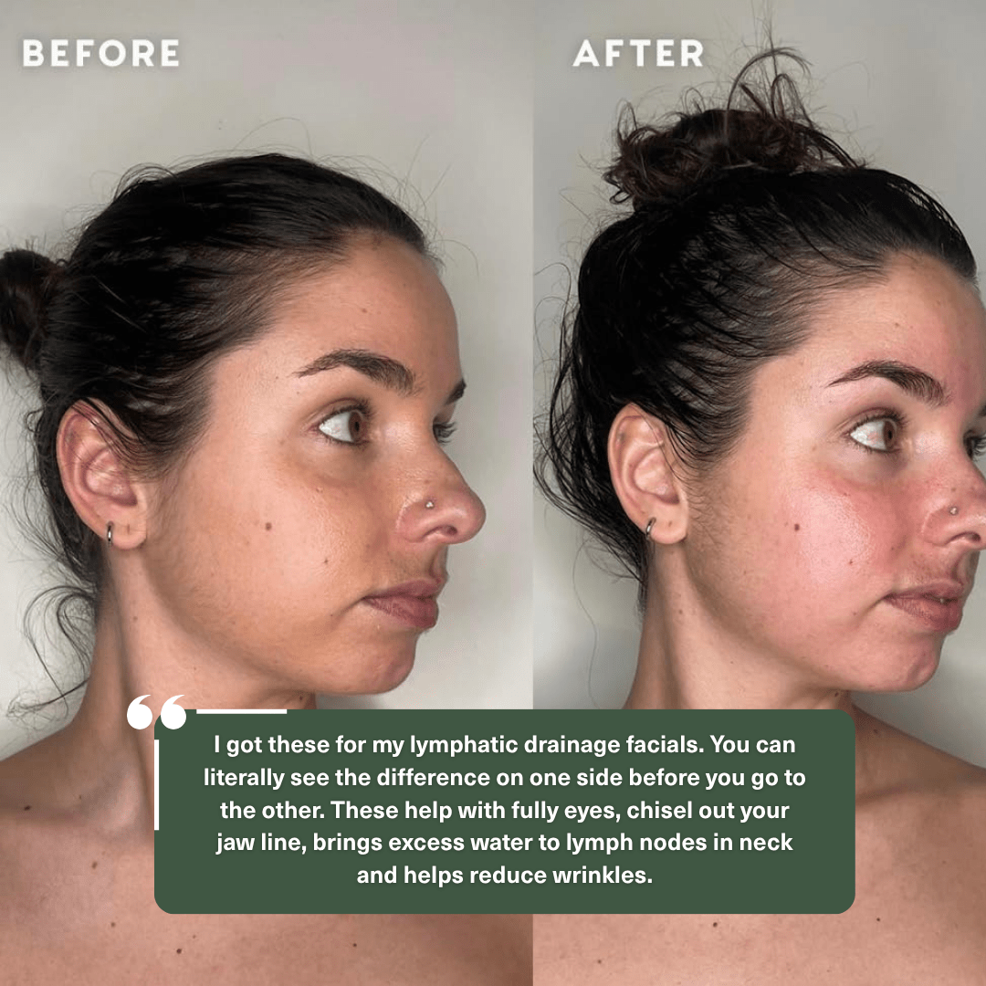 Facial Cupping Set